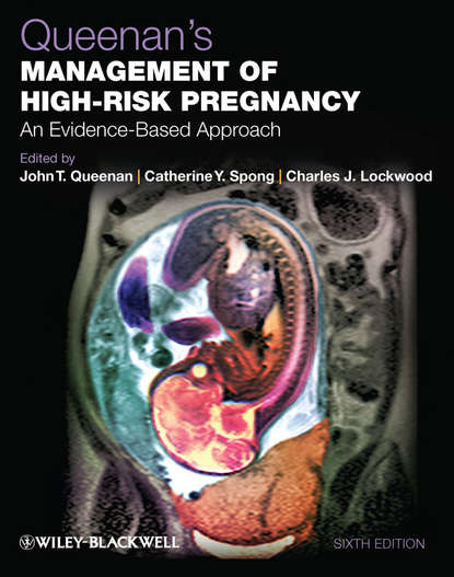 Queenan&apos;s Management of High-Risk Pregnancy. An Evidence-Based Approach