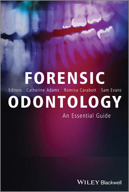 Forensic Odontology. An Essential Guide