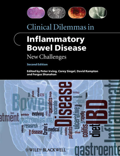 Clinical Dilemmas in Inflammatory Bowel Disease. New Challenges