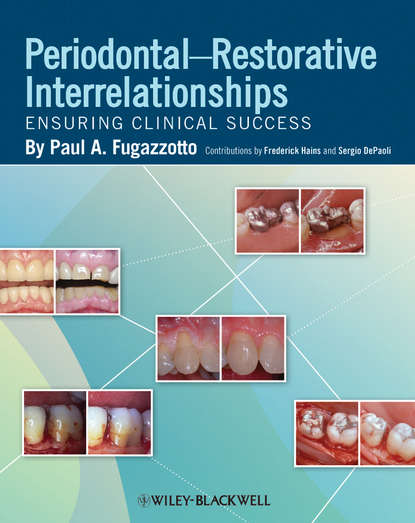 Periodontal-Restorative Interrelationships. Ensuring Clinical Success
