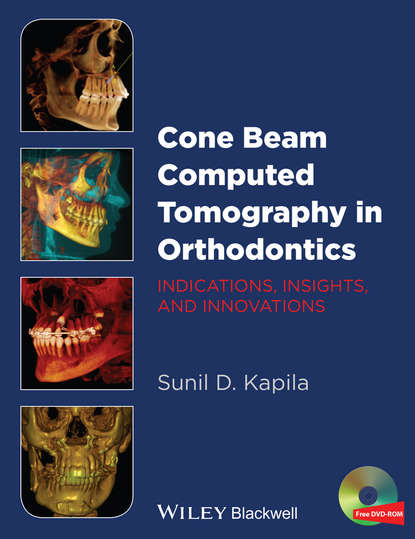 Cone Beam Computed Tomography in Orthodontics. Indications, Insights, and Innovations