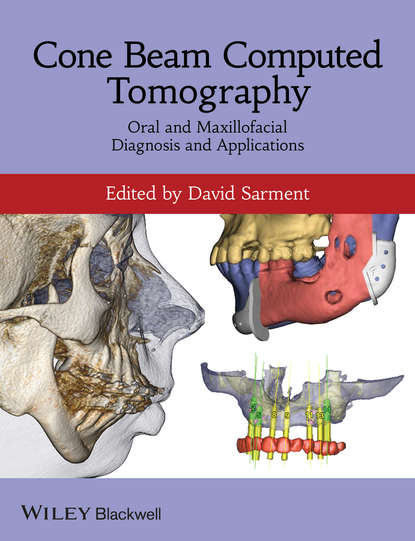 Cone Beam Computed Tomography. Oral and Maxillofacial Diagnosis and Applications