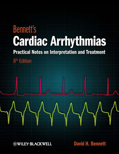 Bennett&apos;s Cardiac Arrhythmias. Practical Notes on Interpretation and Treatment