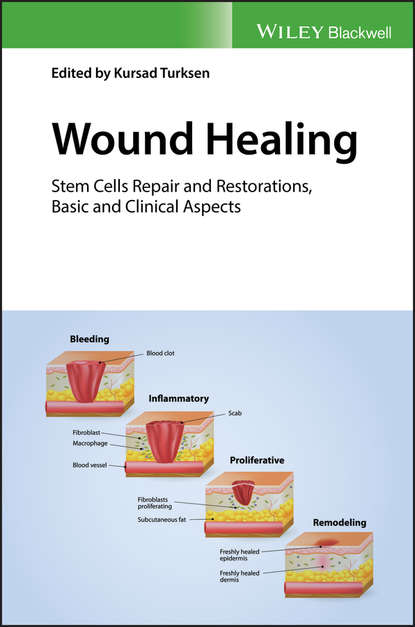 Wound Healing. Stem Cells Repair and Restorations, Basic and Clinical Aspects
