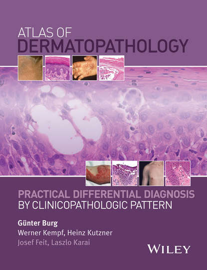 Atlas of Dermatopathology. Practical Differential Diagnosis by Clinicopathologic Pattern