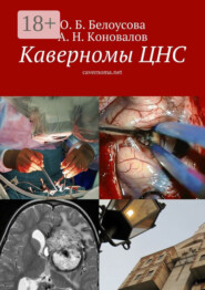 Каверномы ЦНС. cavernoma.net