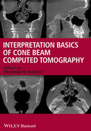 Interpretation Basics of Cone Beam Computed Tomography