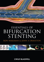 Bifurcation Stenting