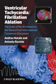 Ventricular Tachycardia / Fibrillation Ablation. The state of the Art based on the VeniceChart International Consensus Document