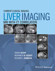 Liver Imaging. MRI with CT Correlation