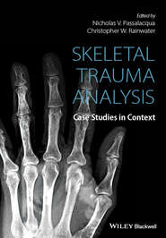 Skeletal Trauma Analysis. Case Studies in Context