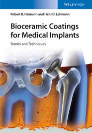 Bioceramic Coatings for Medical Implants. Trends and Techniques