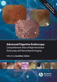 Comprehensive Atlas of High Resolution Endoscopy and Narrowband Imaging