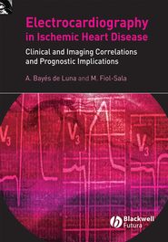 Electrocardiography in Ischemic Heart Disease