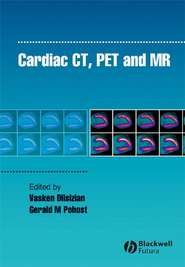 Cardiac CT, PET and MR