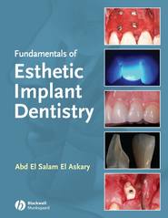 Fundamentals of Esthetic Implant Dentistry