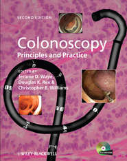 Colonoscopy