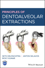 Principles of Dentoalveolar Extractions