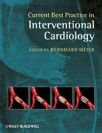 Current Best Practice in Interventional Cardiology