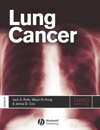 Lung Cancer