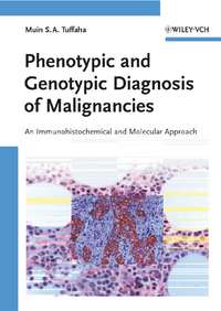 Phenotypic and Genotypic Diagnosis of Malignancies