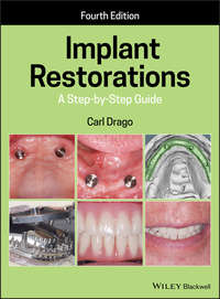 Implant Restorations