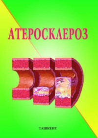 Атеросклероз