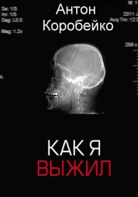 Как я выжил