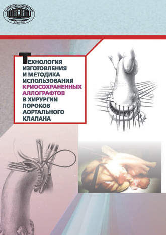 Технология изготовления и методика использования криосохраненных аллографтов в хирургии пороков аортального клапана