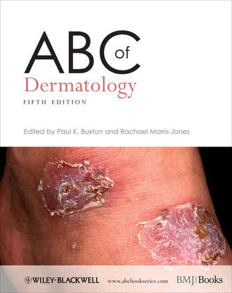 ABC of Dermatology