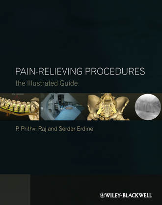 Pain-Relieving Procedures. The Illustrated Guide