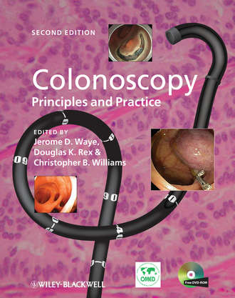 Colonoscopy. Principles and Practice