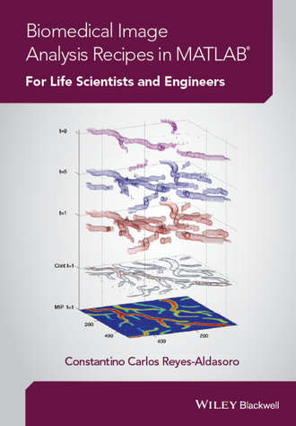 Biomedical Image Analysis Recipes in MATLAB. For Life Scientists and Engineers