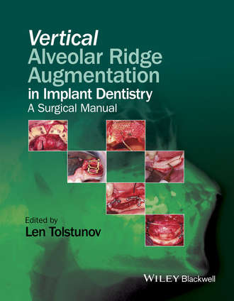 Vertical Alveolar Ridge Augmentation in Implant Dentistry. A Surgical Manual