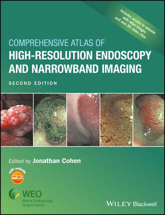 Comprehensive Atlas of High-Resolution Endoscopy and Narrowband Imaging