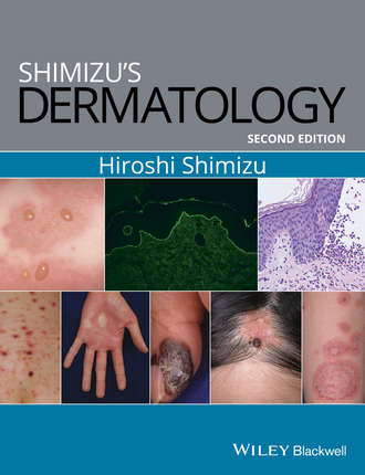 Shimizu&apos;s Dermatology