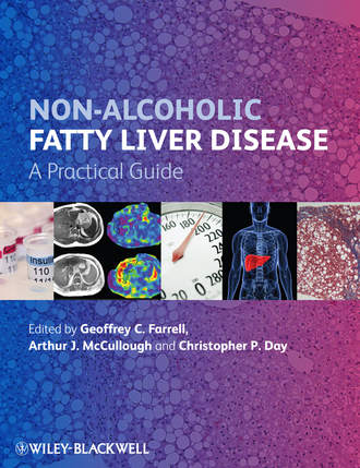 Non-Alcoholic Fatty Liver Disease. A Practical Guide