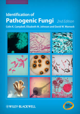 Identification of Pathogenic Fungi