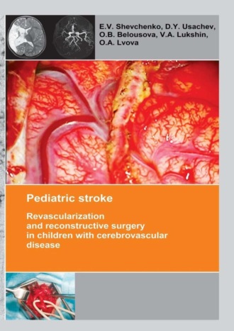 Pediatric stroke. Revascularization and reconstructive surgery in children with cerebrovascular disease