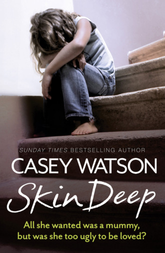 Skin Deep: All She Wanted Was a Mummy, But Was She Too Ugly to Be Loved?