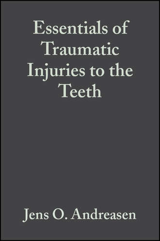 Essentials of Traumatic Injuries to the Teeth