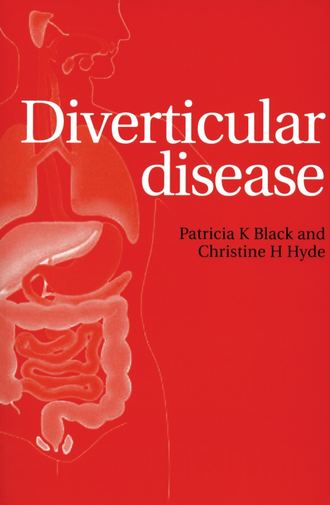 Diverticular Disease