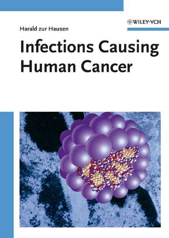 Infections Causing Human Cancer