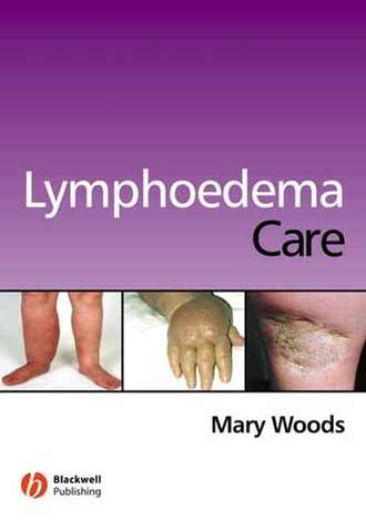 Lymphoedema Care