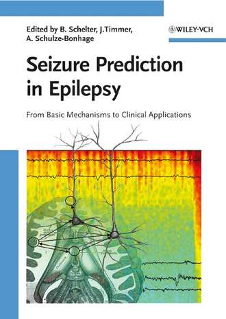 Seizure Prediction in Epilepsy