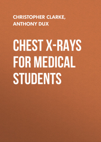 Chest X-Rays for Medical Students