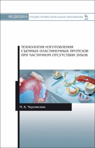 Технология изготовления съемных пластиночных протезов при частичном отсутствии зубов