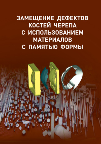 Замещение дефектов костей черепа с использованием материалов с памятью формы