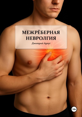 Межрёберная невралгия